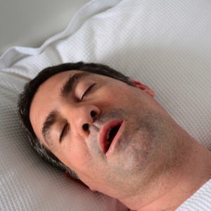 sleep apnea