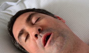 sleep apnea