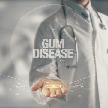 stages of gum disease