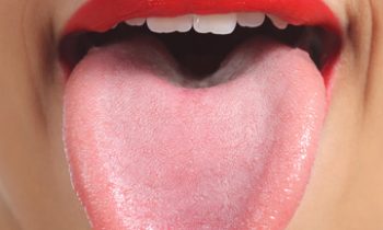 how to tell if you have tongue thrust