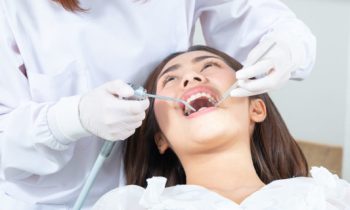 deep dental cleaning