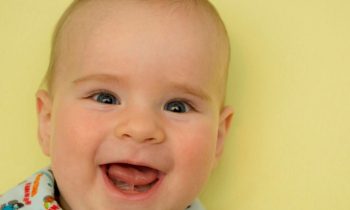 how are infant tongue ties treated