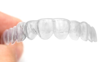 overview of invisalign