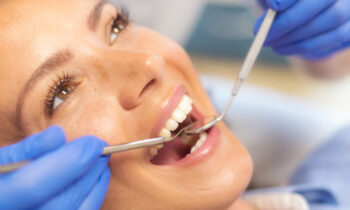 how do dentist detect cavities